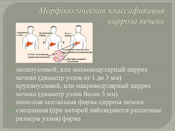Морфологическая классификация цирроза печени мелкоузловой, или мелконодулярный цирроз печени (диаметр узлов от 1 до