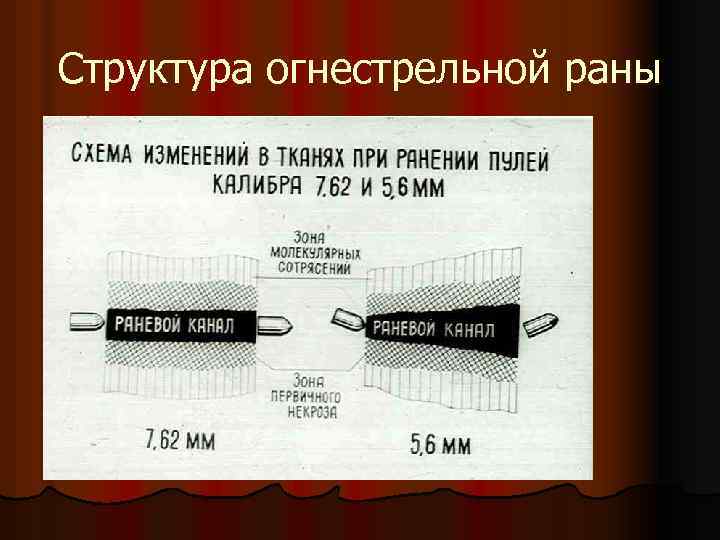 Структура огнестрельной раны 