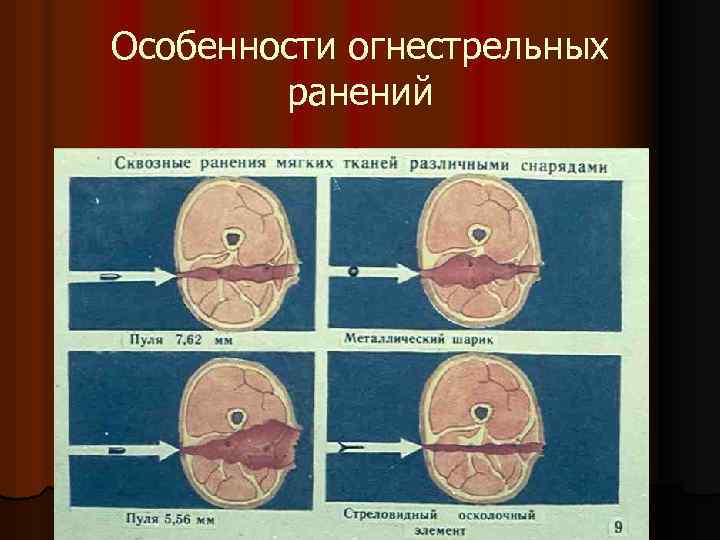 Особенности огнестрельных ранений 