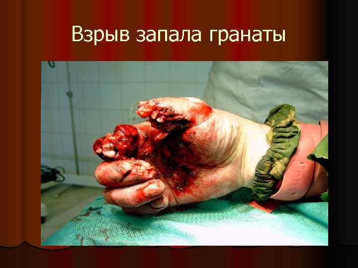 Взрыв запала гранаты 