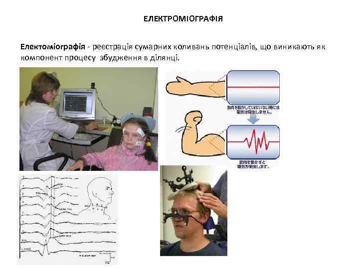 ЕЛЕКТРОМІОГРАФІЯ Електоміографія - реєстрація сумарних коливань потенціалів, що виникають як компонент процесу збудження в