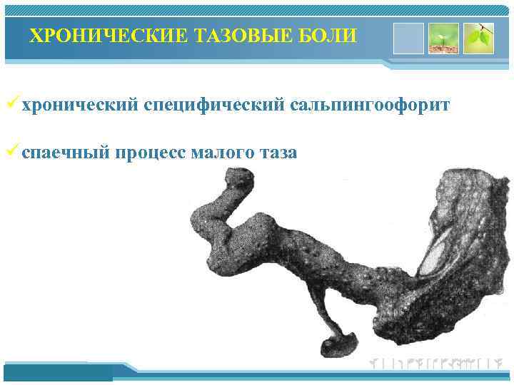 ХРОНИЧЕСКИЕ ТАЗОВЫЕ БОЛИ üхронический специфический сальпингоофорит üспаечный процесс малого таза www. themegallery. com 