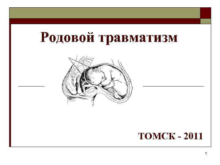 Родовой травматизм ТОМСК - 2011 1 