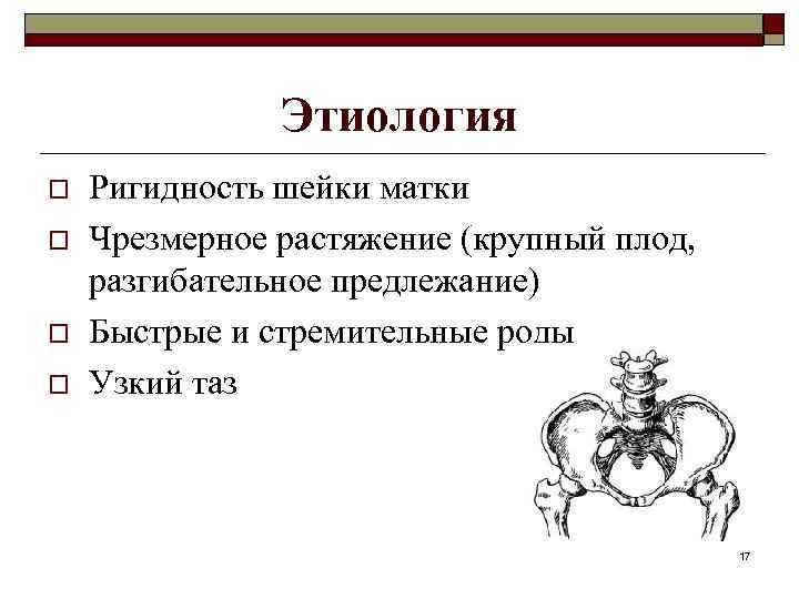 Этиология o o Ригидность шейки матки Чрезмерное растяжение (крупный плод, разгибательное предлежание) Быстрые и