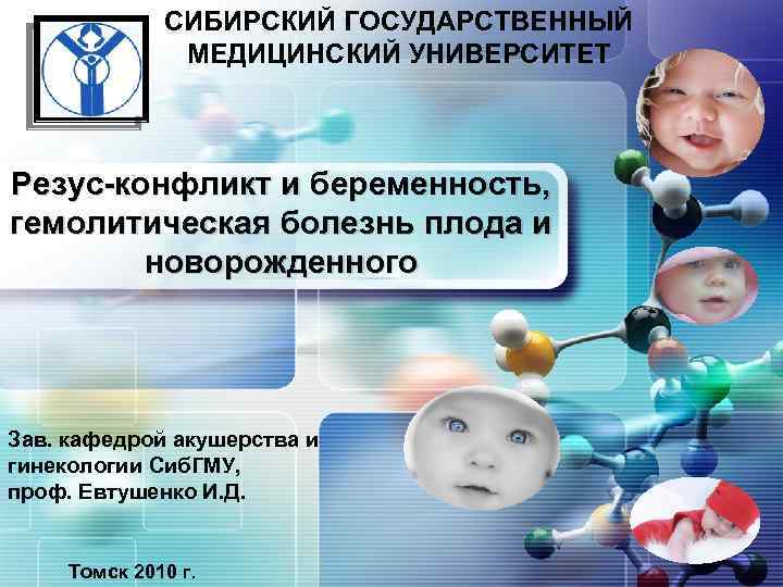 LOGO СИБИРСКИЙ ГОСУДАРСТВЕННЫЙ МЕДИЦИНСКИЙ УНИВЕРСИТЕТ Резус-конфликт и беременность, гемолитическая болезнь плода и новорожденного Зав.