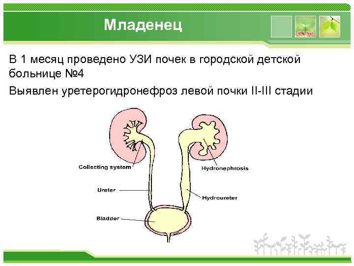 Младенец В 1 месяц проведено УЗИ почек в городской детской больнице № 4 Выявлен