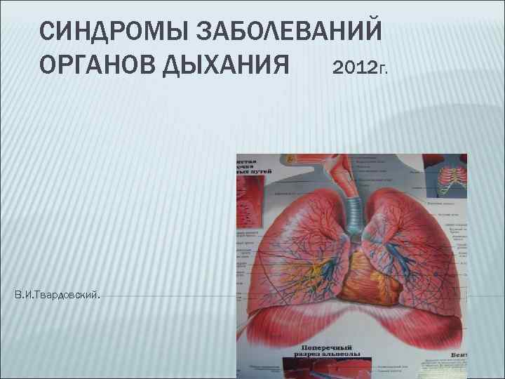 СИНДРОМЫ ЗАБОЛЕВАНИЙ ОРГАНОВ ДЫХАНИЯ 2012 Г. В. И. Твардовский. 