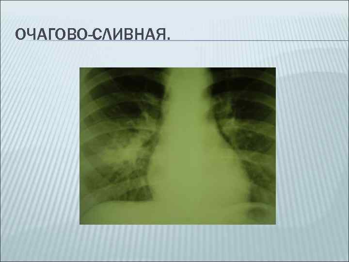 ОЧАГОВО-СЛИВНАЯ. 