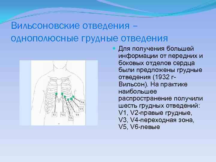 Вильсоновские отведения – однополюсные грудные отведения Для получения большей информации от передних и боковых