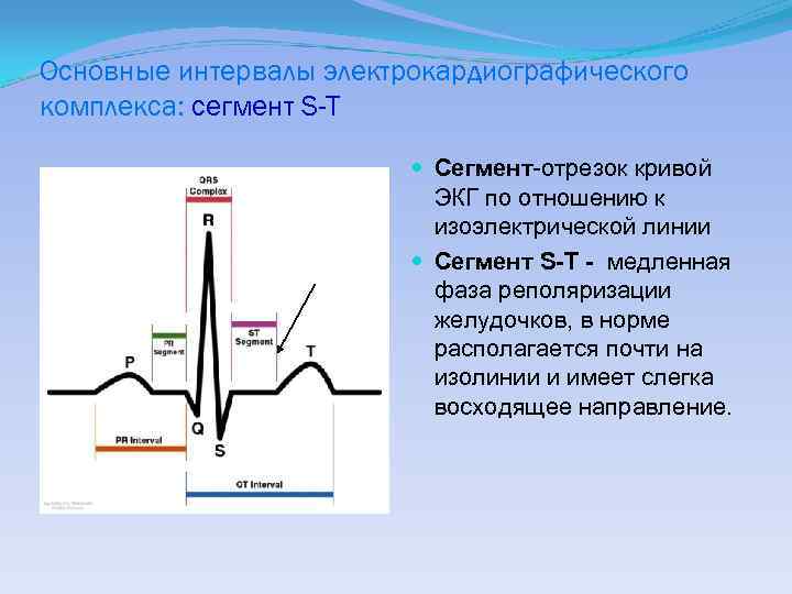 Основные интервалы электрокардиографического комплекса: сегмент S-T Сегмент-отрезок кривой ЭКГ по отношению к изоэлектрической линии