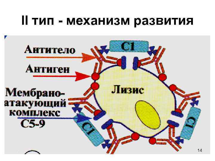 II тип - механизм развития 14 