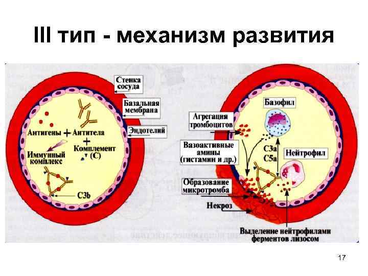 III тип - механизм развития 17 