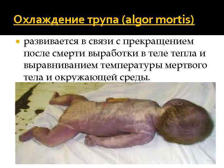 Охлаждение трупа (algor mortis) развивается в связи с прекращением после смерти выработки в теле