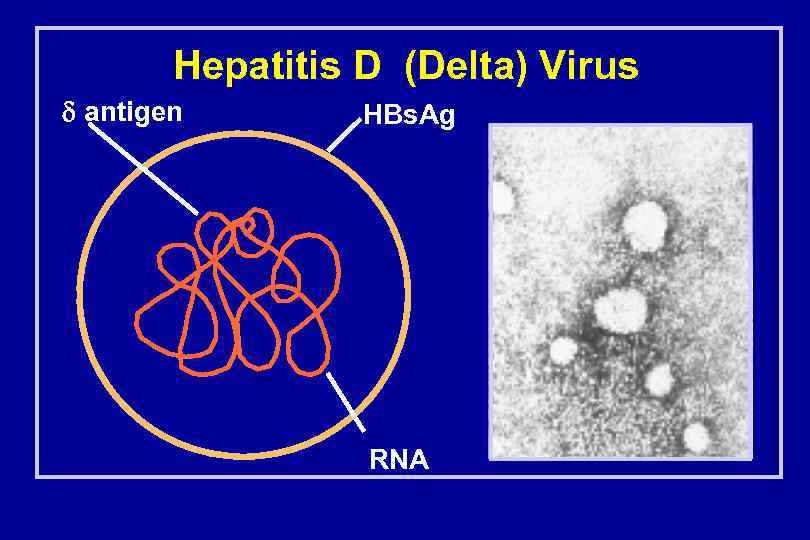 Hepatitis D (Delta) Virus antigen HBs. Ag RNA 