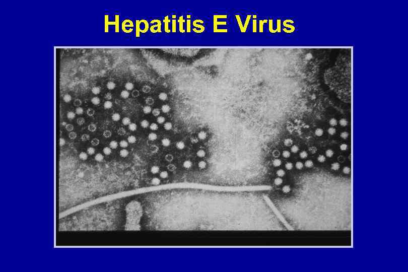 Hepatitis E Virus 