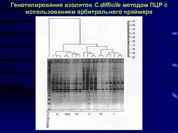 Генотипирование изолятов C. difficile методом ПЦР с использованием арбитрального праймера 