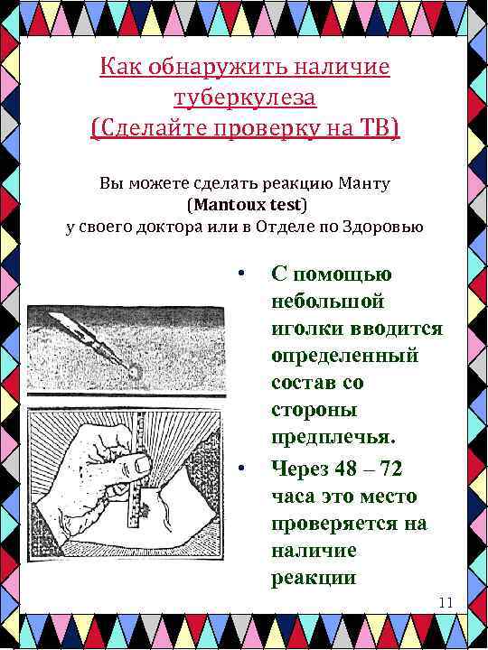 Как обнаружить наличие туберкулеза (Сделайте проверку на TB) Вы можете сделать реакцию Манту (Mantoux