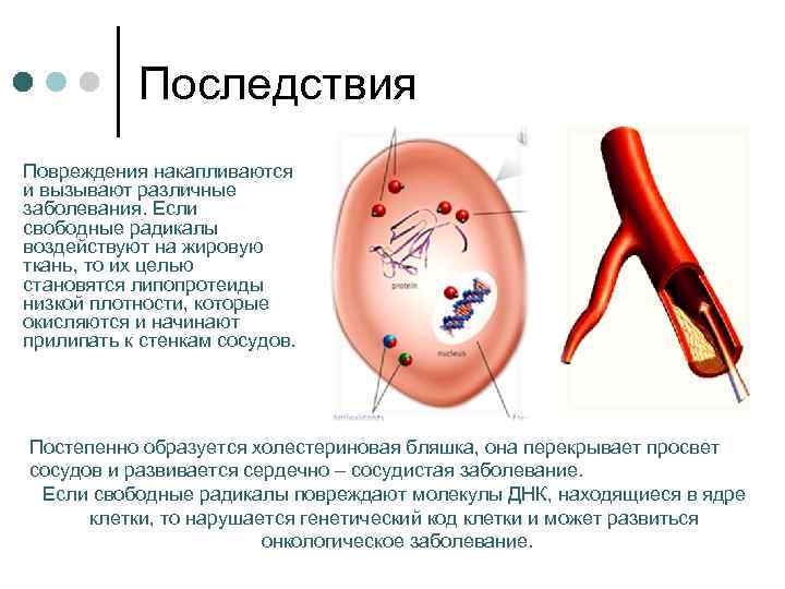 Свободные сосуды. Свободные радикалы вызывают повреждения. Повреждение свободными радикалами это. Последствия свободные радикалов заболевания. Свободные радикалы повреждают сосуды.