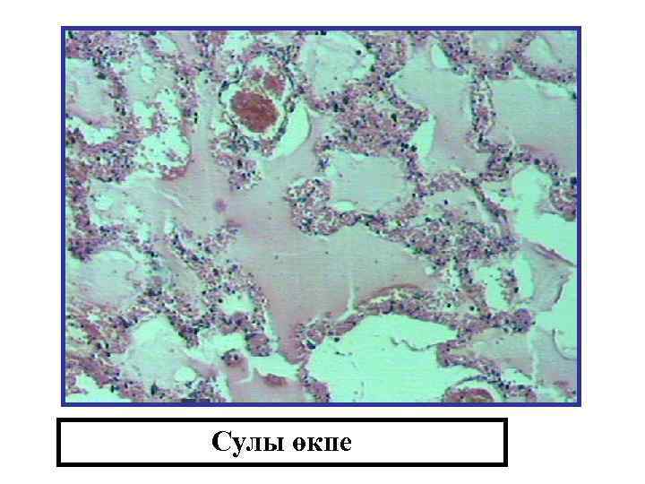 Сулы өкпе 