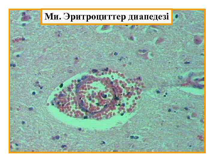 Ми. Эритроциттер диапедезі 