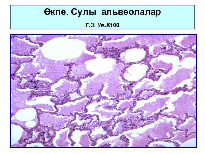 Өкпе. Сулы альвеолалар Г. Э. Ув. Х 100 