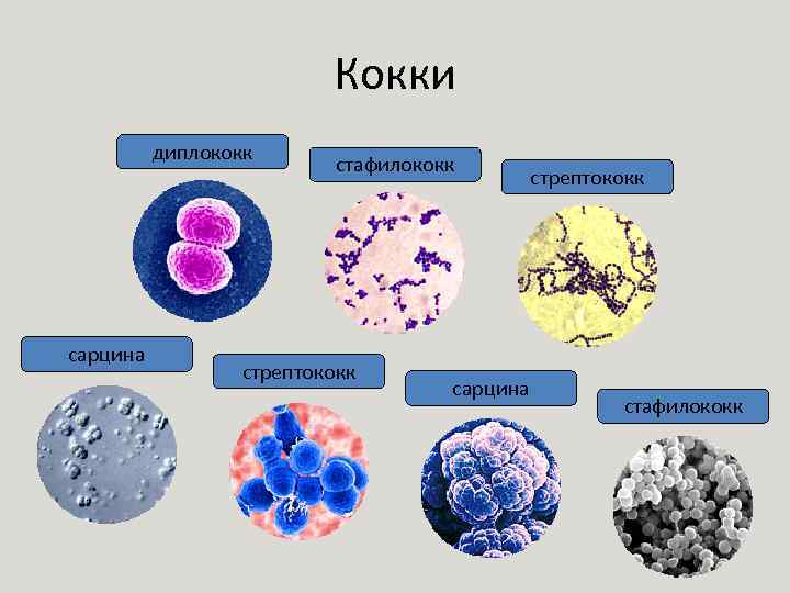 Кокки диплококк сарцина стафилококк стрептококк сарцина стрептококк стафилококк 