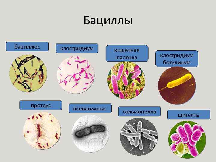 Бациллы бациллюс протеус клостридиум псевдомонас кишечная палочка сальмонелла клостридиум ботулинум шигелла 