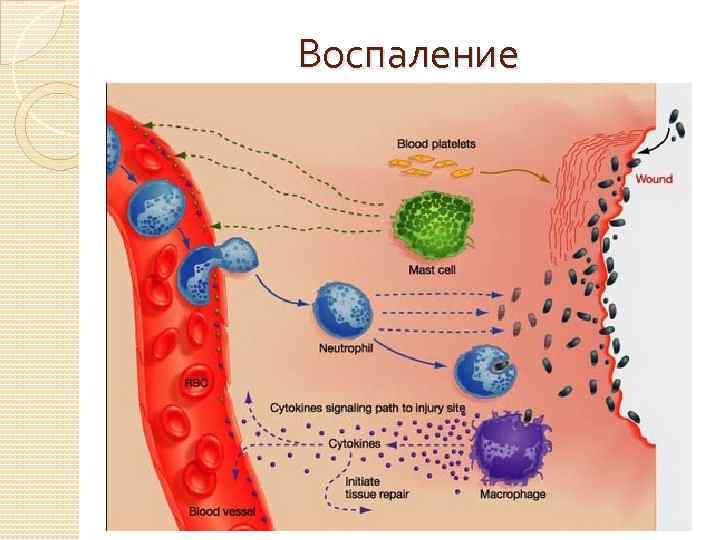 Воспаление 