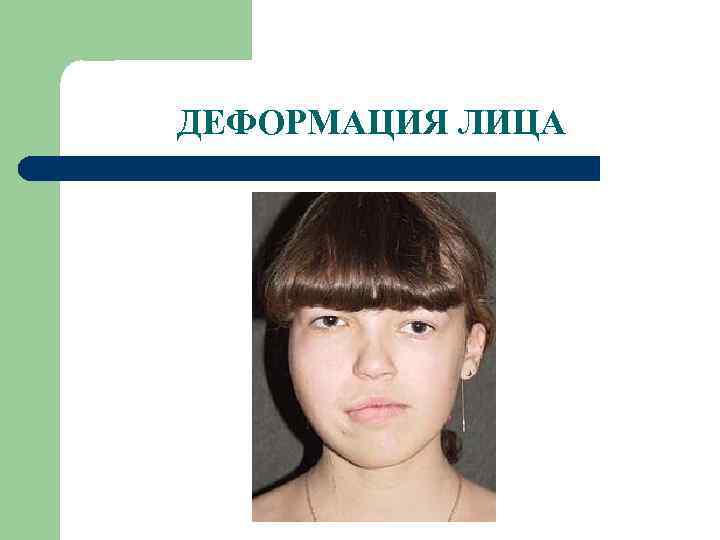 ДЕФОРМАЦИЯ ЛИЦА 