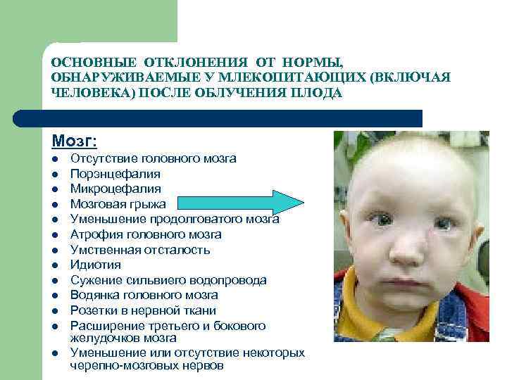 ОСНОВНЫЕ ОТКЛОНЕНИЯ ОТ НОРМЫ, ОБНАРУЖИВАЕМЫЕ У МЛЕКОПИТАЮЩИХ (ВКЛЮЧАЯ ЧЕЛОВЕКА) ПОСЛЕ ОБЛУЧЕНИЯ ПЛОДА Мозг: l