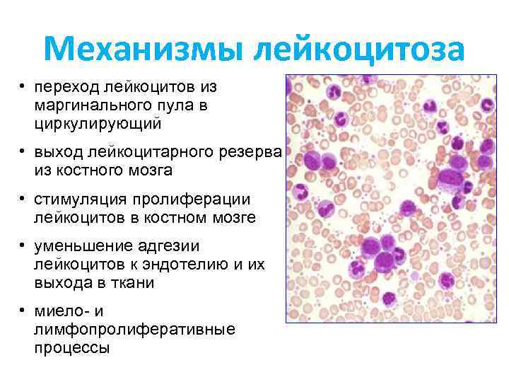 Механизмы лейкоцитоза • переход лейкоцитов из маргинального пула в циркулирующий • выход лейкоцитарного резерва