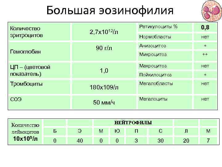 Большая эозинофилия Количество эритроцитов Ретикулоциты % 0, 8 Нормобласты 2, 7 х1012/л нет Анизоцитоз