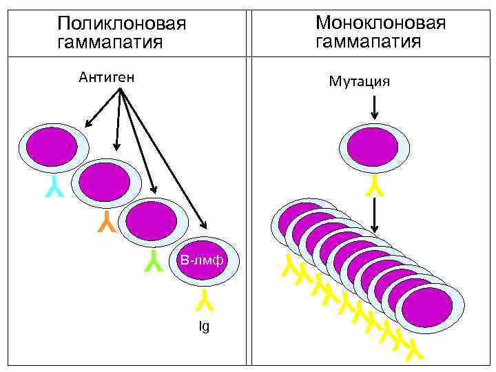 Моноклоновая гаммапатия Поликлоновая гаммапатия Антиген Мутация Y Y Ig Y Y YY Y В-лмф