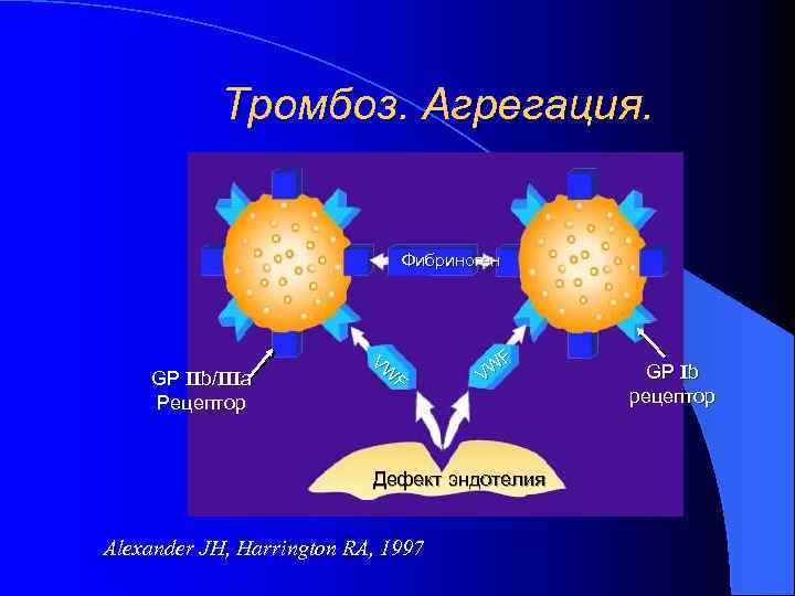 Тромбоз. Агрегация. Фибриноген GP IIb/IIIa Рецептор VW F F W V Дефект эндотелия Alexander