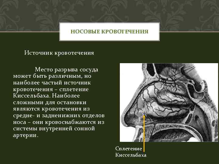 НОСОВЫЕ КРОВОТЕЧЕНИЯ Источник кровотечения Место разрыва сосуда может быть различным, но наиболее частый источник
