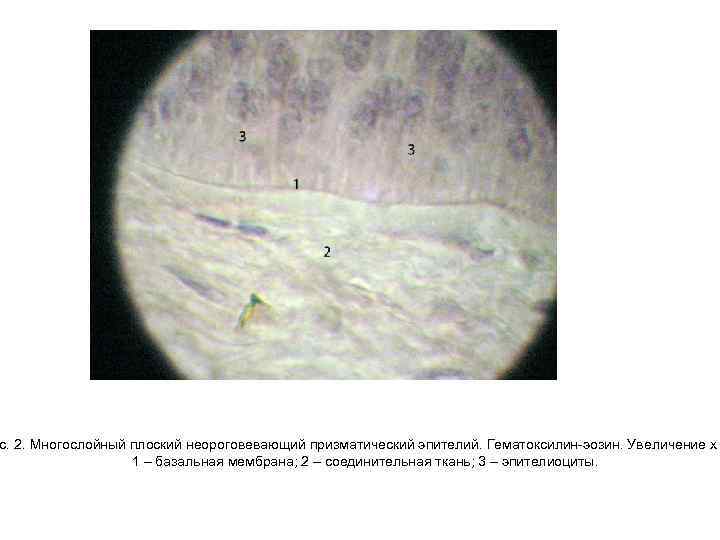 с. 2. Многослойный плоский неороговевающий призматический эпителий. Гематоксилин-эозин. Увеличение х 1 – базальная мембрана;