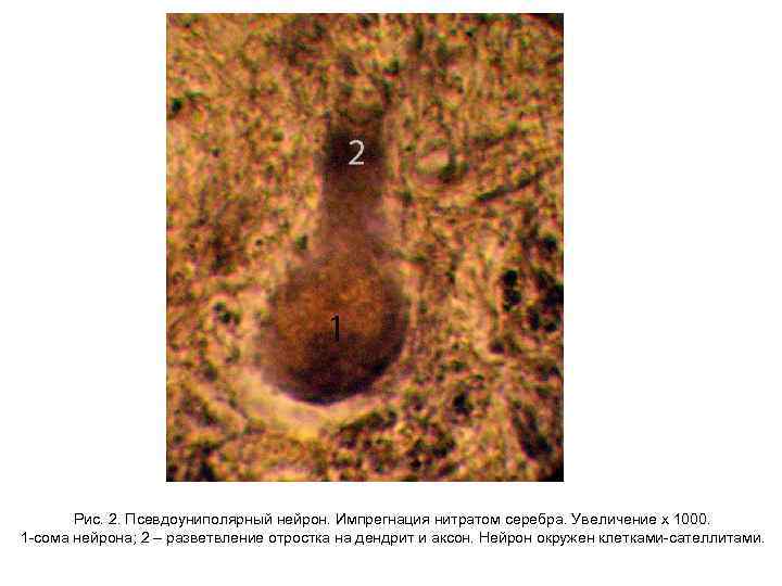 Рис. 2. Псевдоуниполярный нейрон. Импрегнация нитратом серебра. Увеличение х 1000. 1 -сома нейрона; 2
