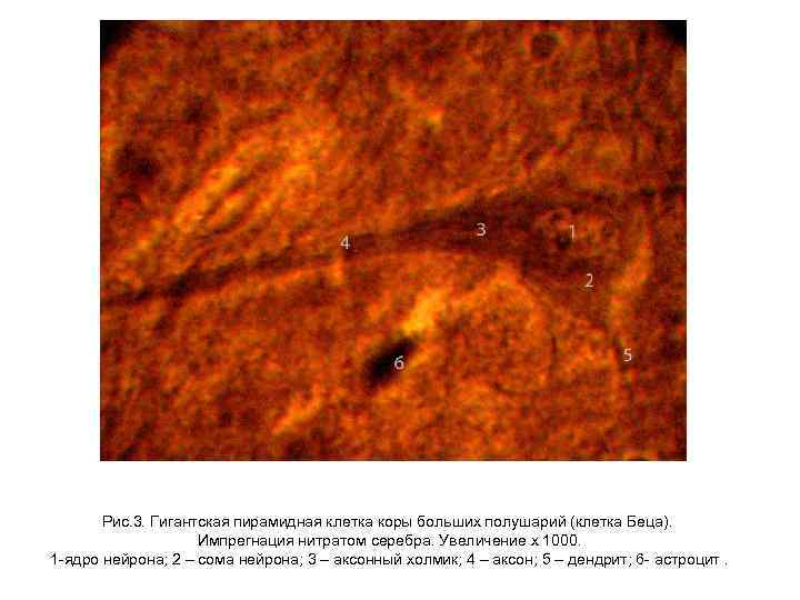 Рис. 3. Гигантская пирамидная клетка коры больших полушарий (клетка Беца). Импрегнация нитратом серебра. Увеличение