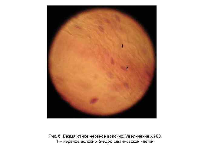 Рис. 6. Безмякотное нервное волокно. Увеличение х 900. 1 – нервное волокно. 2 -ядро