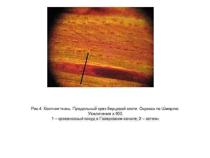 Рис. 4. Костная ткань. Продольный срез берцовой кости. Окраска по Шморлю. Увеличение х 600.