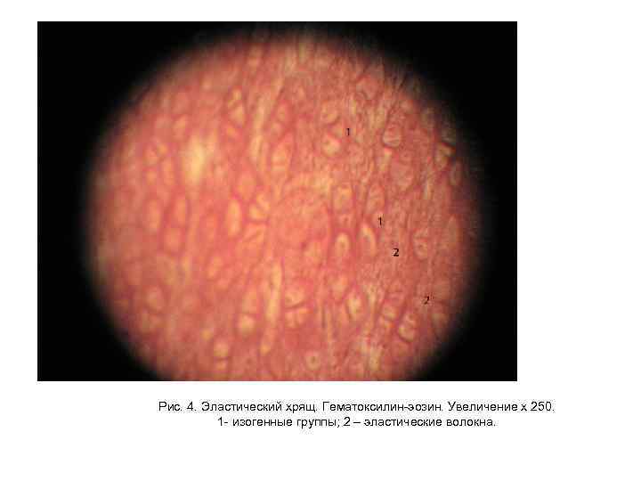 Рис. 4. Эластический хрящ. Гематоксилин-эозин. Увеличение х 250. 1 - изогенные группы; 2 –