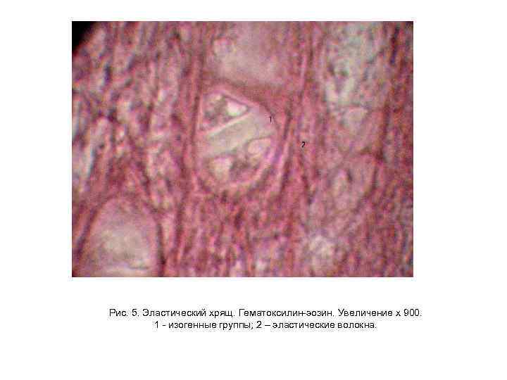 Рис. 5. Эластический хрящ. Гематоксилин-эозин. Увеличение х 900. 1 - изогенные группы; 2 –