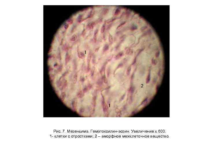 Рис. 7. Мезенхима. Гематоксилин-эозин. Увеличение х 600. 1 - клетки с отростками; 2 –