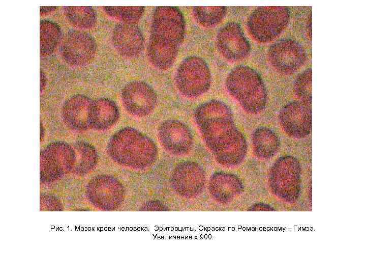Эритроциты в мазке. Лейкоциты мазок крови человека окраска по Романовскому Гимза. Мазок крови человека окраска Азур 2 эозином. Окраска Романовский Гимза кровь. Мазок крови лягушки гематоксилин-эозин.