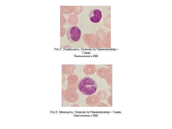 Рис. 7. Лимфоциты. Окраска по Романовскому – Гимза. Увеличение х 900. Рис. 8. Моноциты.