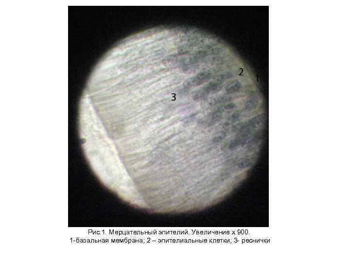 Рис. 1. Мерцательный эпителий. Увеличение х 900. 1 -базальная мембрана; 2 – эпителиальные клетки;