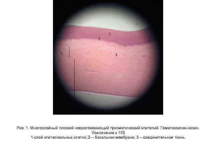 Рис. 1. Многослойный плоский неороговевающий призматический эпителий. Гематоксилин-эозин. Увеличение х 100. 1 -слой эпителиальных