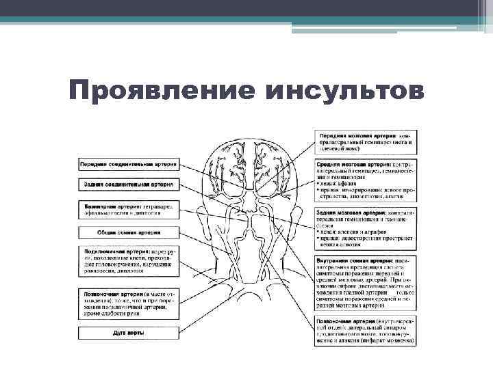 Проявление инсультов 