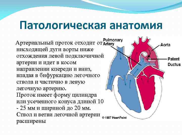 Схема артерий отходящих от аорты