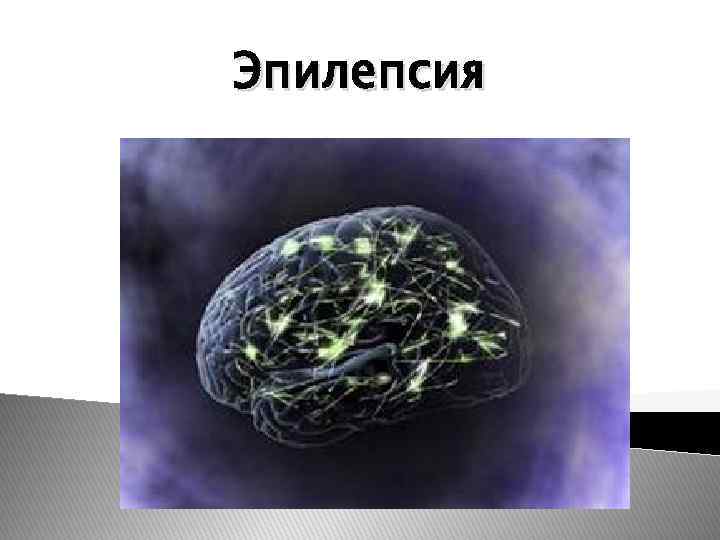 Эпилепсия 